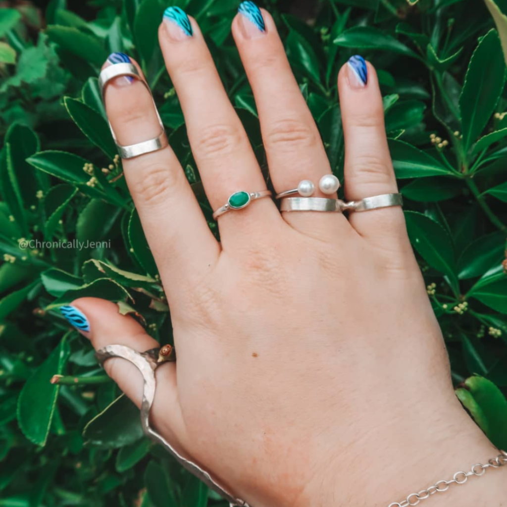 A close-up of Jenni's hand with various silver ring splints on her fingers.