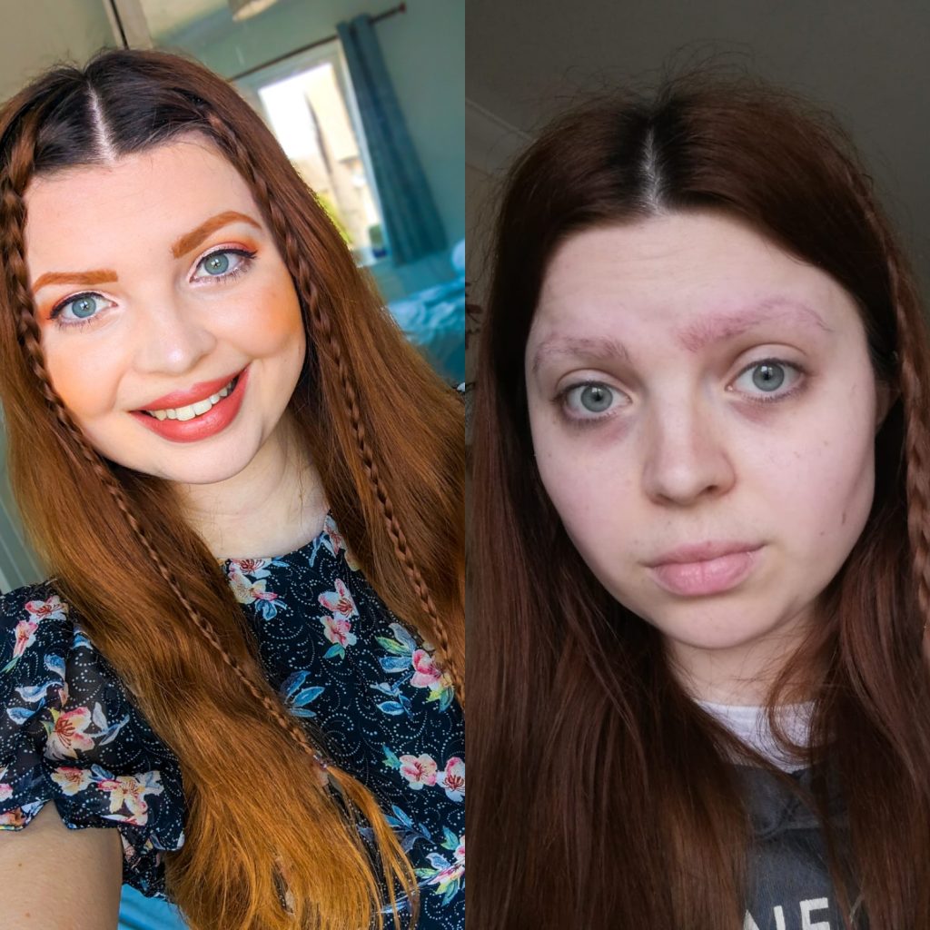 two side by side selfies of Jenni. on one side she is dressed up with her hair and makeup done smiling at the camera. In the other she is wearing a hoodie, looking pale with dark circles under her eyes and she has no eyebrows and the area around them is red because she has pulled them out.