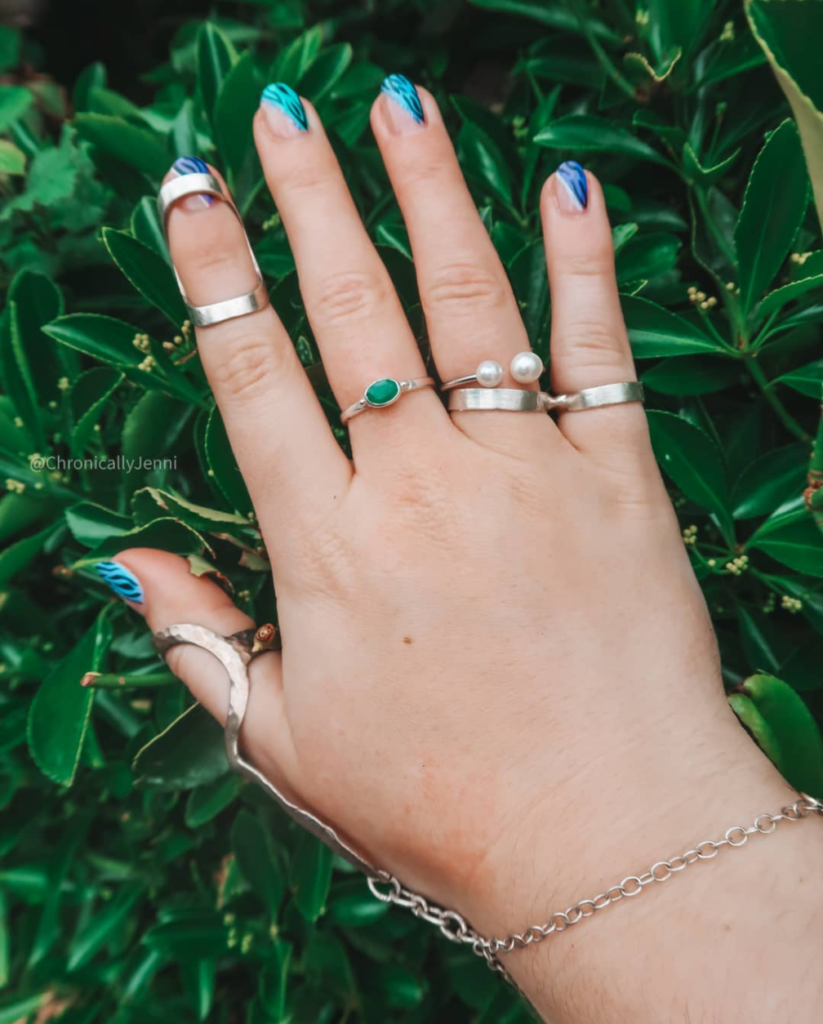 A close-up of Jenni's hand with various silver ring splints on her fingers.